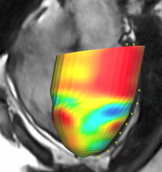 Cardiovascular Magnetic Resonance Imaging