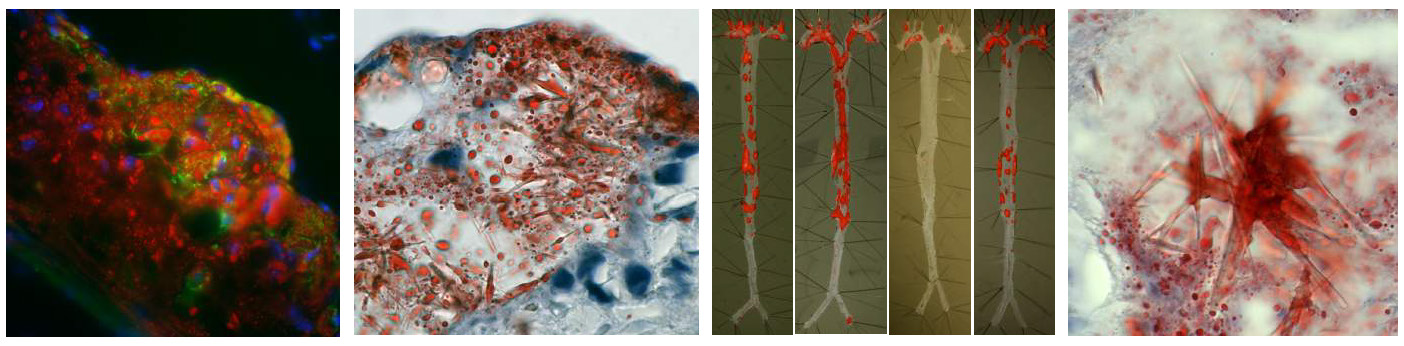 Images Cardiovascular Immunobiology