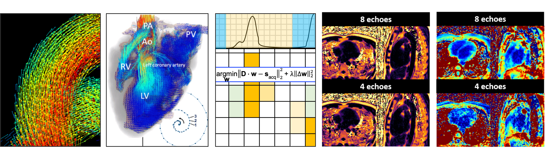 MRI Images