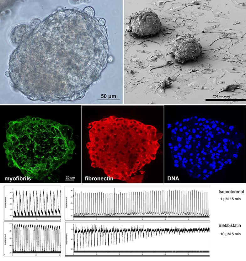 Cardiomyocyte