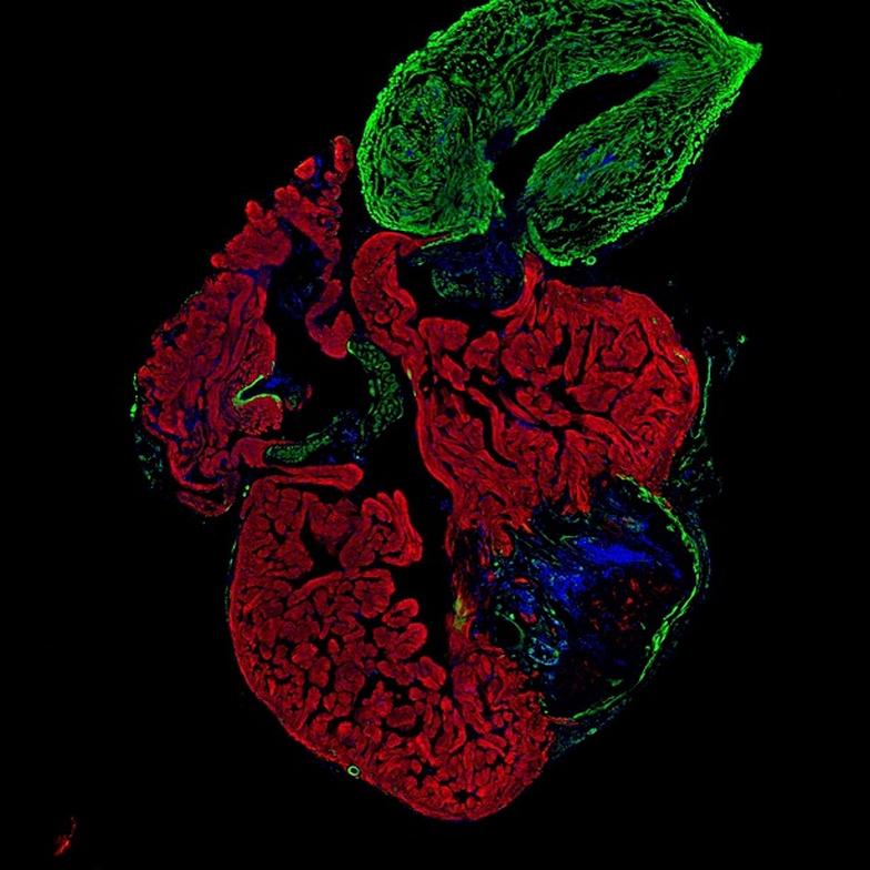 cryoinjury zebrafish