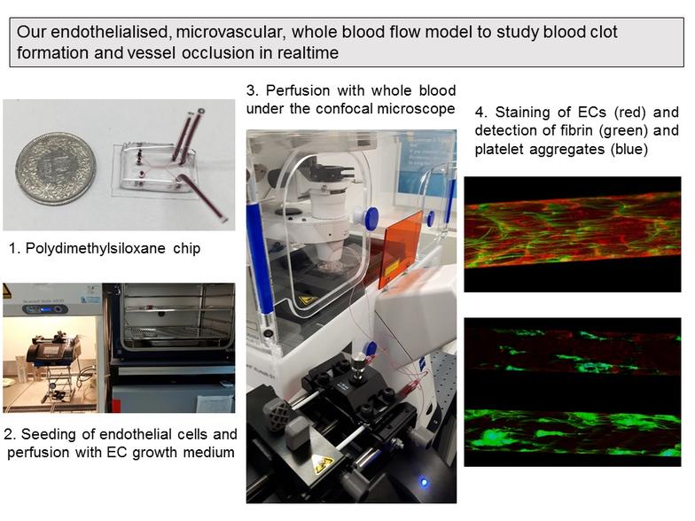 microvascular flow model